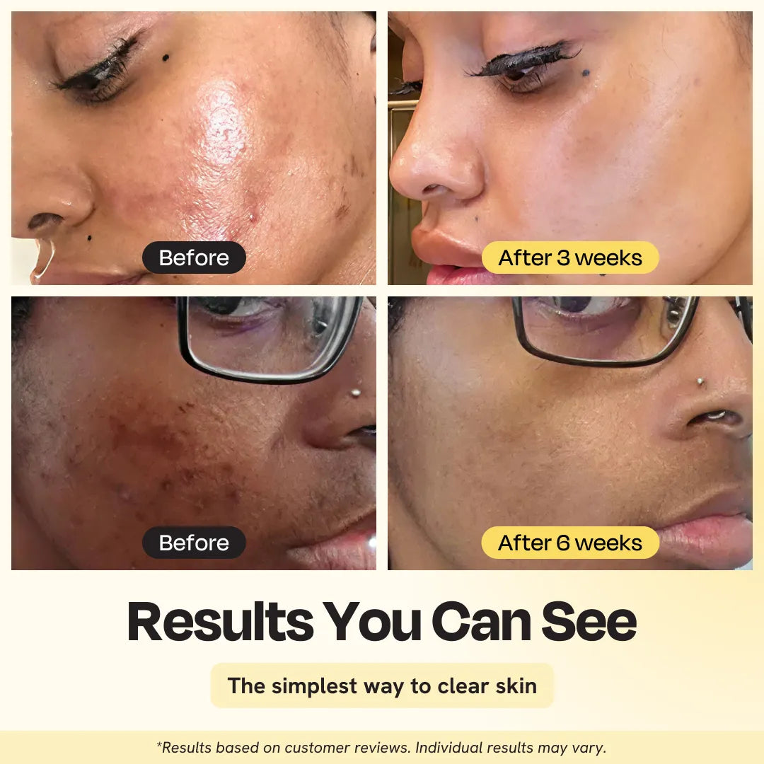 Jumbo Vitamin C Tonmaske